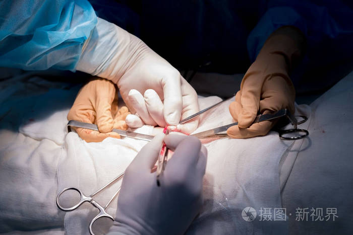 外科缝线在无菌手术室里外科医生和助手的手在病人孩子的皮肤上进行