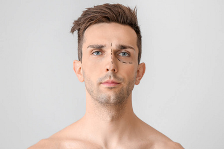 肖像 眼睑成形术 治疗 健康 医学 医生 身体 应用 面对