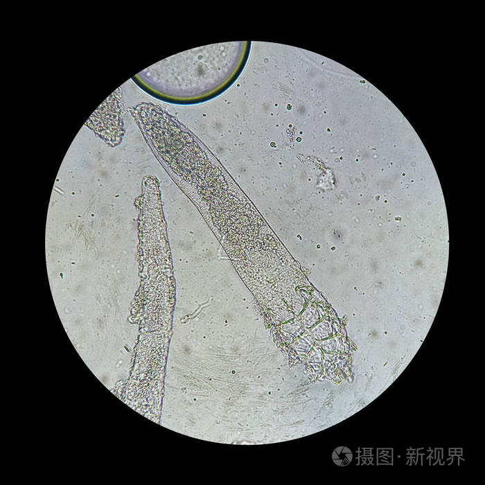 显微镜下的蠕形螨引起皮肤病的寄生虫蠕形螨