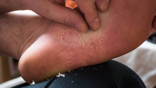 舔着脚上的皮照片