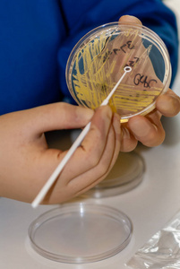 药物治疗 疫苗 实验 解决方案 化学 玻璃 病毒 玻璃器皿