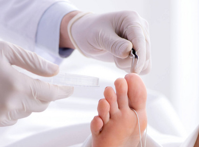 尸体脚底板图片