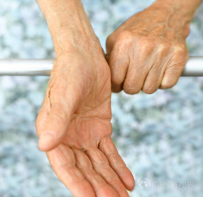 老太太张开手掌这位老太太正在等待帮助退休疗养院的老太太老年人老龄
