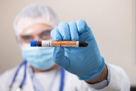 收集 病毒 实验室 麻疹 医生 面具 微生物学 健康 测试