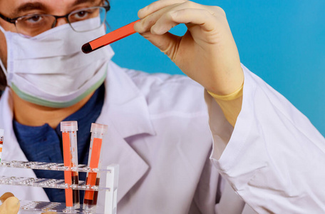 实验室 健康 瓷器 大流行 样品 医生 等离子体 生物化学