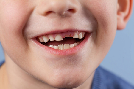 宝宝掉牙了.照片