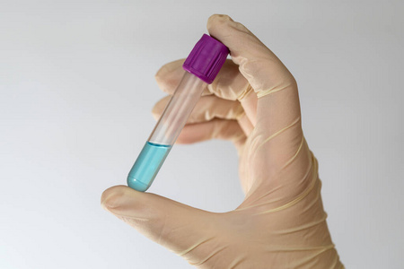 科学家手里拿着蓝色透明化学液体的试管。手戴乳胶手套。真空试管。