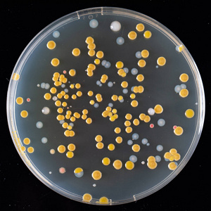 科学 感染 微生物学 病菌 生物技术 测试 细菌 照顾 琼脂