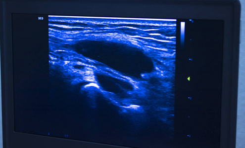 针刺 理疗师 物理疗法 屏幕 健康 运动 超声波 治疗专家