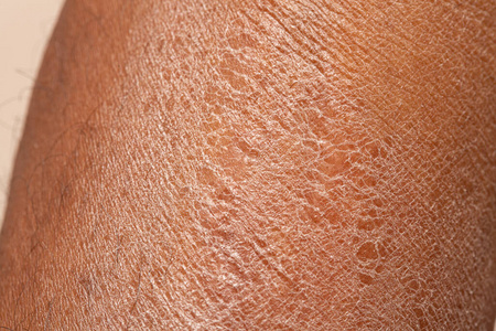 紫外线 护肤品 保湿 奶油 辐射 防晒霜 洗剂 太阳 射线