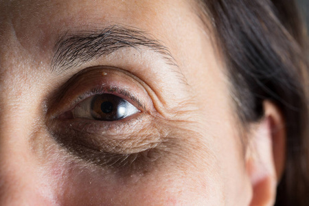 眼袋美女图片-眼袋美女素材-眼袋美女插画-摄图新视界