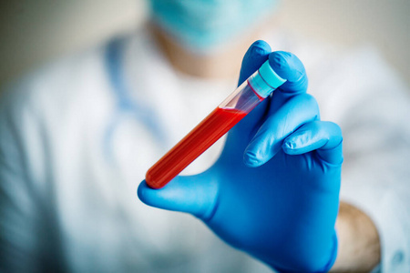 科学家验血.新流行性冠状病毒2019 ncov.带复制空间的背景.水平.照片