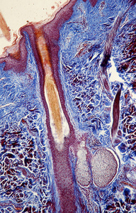 组织 头皮 皮肤 细胞 研究 显微镜检查 放大倍数 组织学