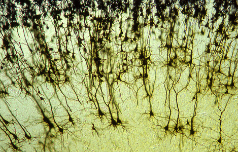 科学 组织 放大倍数 突触 研究 左边 细胞 神经元 显微镜检查