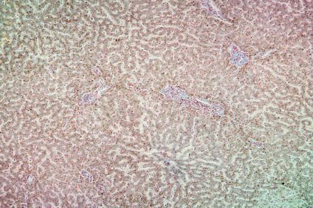 科学 扩大 放大倍数 细胞 病理学 肝脏 组织 医学 显微镜检查