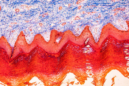 细胞 布鲁 显微镜检查 皮肤 组织 扩大 科学 疤痕 医学