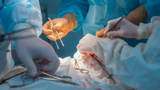 外科手术 疼痛 专业人士 治疗 麻醉师 助理 外科医生 医学