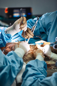 轮廓整容手术.真正的手术,是一组外科医生在鼻子上做手术.