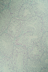 组织学 显微镜检查 科学 繁殖 检查 精子 医生 组织