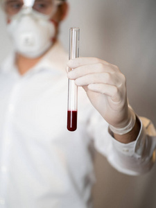 研究 测试 微生物学 玻璃 等离子体 诊所 临床 发现 科学家