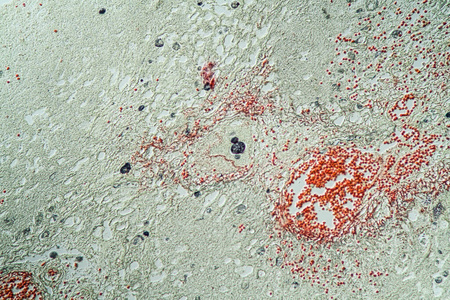 显微镜检查 康复 细胞 扩大 组织学 学习 感染 细菌 寄生虫