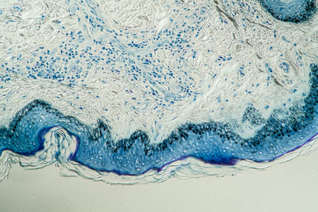检查 细胞 组织学 麻风病 研究 皮肤 疾病 扩大 科学