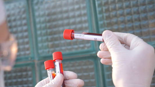 爆发 流感 呼吸系统 新型冠状病毒 光晕 接种疫苗 实验室