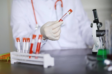 病毒 化学家 医学 样品 测试 科学 创新 实验室 流感