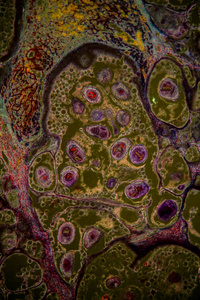 显微镜检查 炎症 科学 棘球蚴 寄生虫 黑暗地带 扩大 放大倍数
