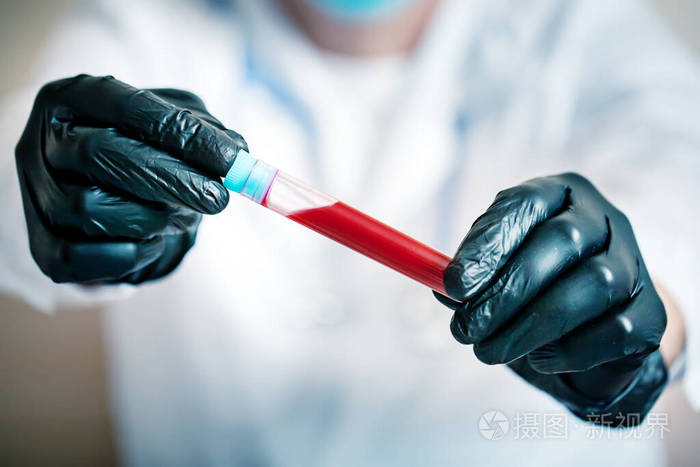 冠状病毒的流行医生拿着一瓶血样的手