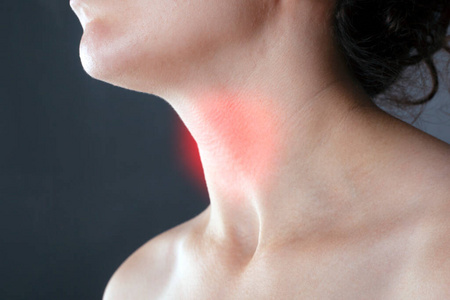 喉咙痛过敏感冒心绞痛.淋巴结发炎女人的脖子上的刀疤鼹鼠甲状腺肿大.