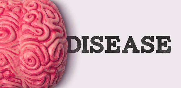 人类大脑模型旁边的疾病词图片