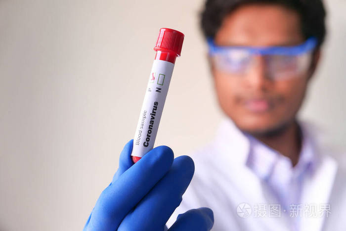 laboratory technician hand holding blood test tube