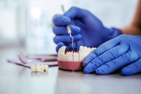 牙科 科学家 牙医 微生物学 健康 样品 测试 研究 技术