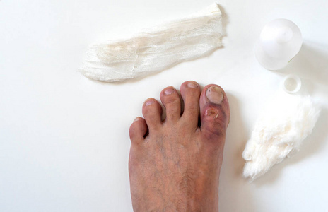 淤青图片-淤青素材-淤青插画-摄图新视界