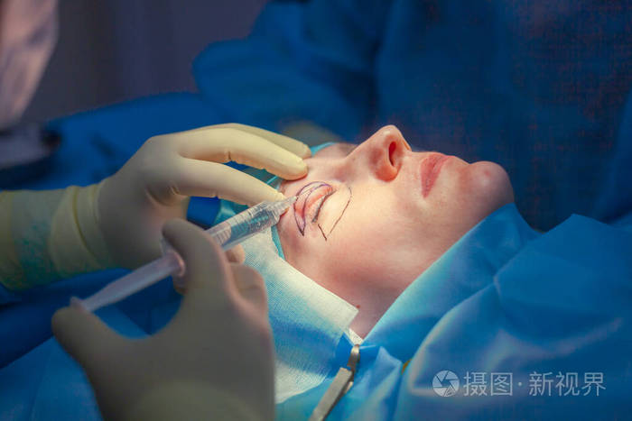 在进行眼睑提升手术之前外科医生在病人的上眼睑注射眼睑成形术