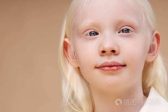 漂亮的金发白化病孩子与世隔绝