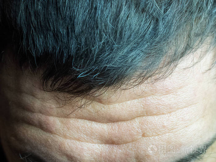 一个男人额头上布满皱纹的特写照片