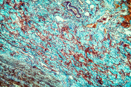 结肠 显微镜检查 组织 研究 组织学 医学 细菌 细胞 科学