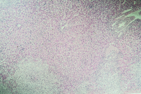 腐烂 科学 医学 显微镜检查 组织 研究 病理学 热带 水蛭