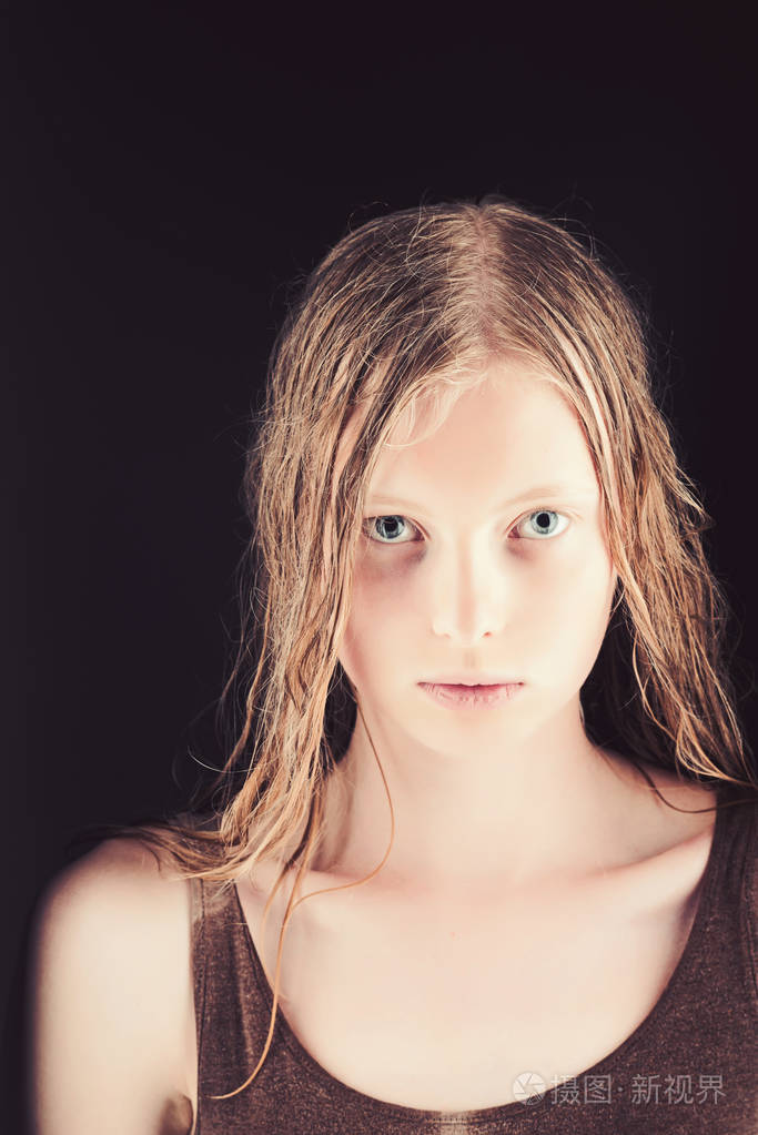 白化病妇女湿金发,白化病.白化病女孩蓝眼睛白皮肤照片-正版商用图片2