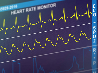 心电图心动频率图片