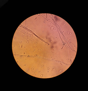 真菌菌丝体丝状体增加40倍的显微镜观察照片