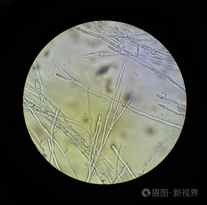 真菌菌丝革兰染色图片