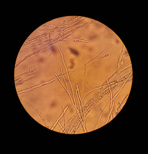 体微生物真菌菌丝体丝状体增加40倍的显微镜观察照片