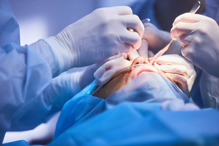 眼睑成形术,一种整形手术,用于矫正眼睑的缺陷,畸形和缺陷,并对面部的