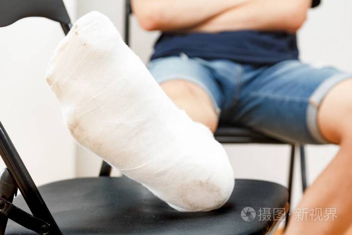 坐男腿伤石膏脚