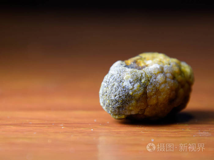 大结石胆囊结石胆结石的结果