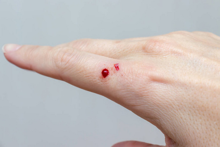 伤口流血图片-伤口流血素材-伤口流血插画-摄图新视界