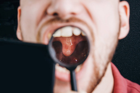 医生看舌头图片